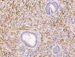 Actin Antibody in Immunohistochemistry (Paraffin) (IHC (P))