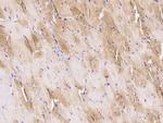 Actin Antibody in Immunohistochemistry (Paraffin) (IHC (P))