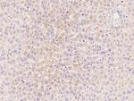 CPT2 Antibody in Immunohistochemistry (Paraffin) (IHC (P))