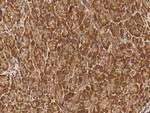 MCTS1 Antibody in Immunohistochemistry (Paraffin) (IHC (P))