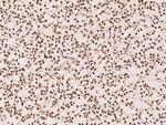 PTBP1 Antibody in Immunohistochemistry (Paraffin) (IHC (P))