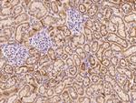 ADAM10 Antibody in Immunohistochemistry (Paraffin) (IHC (P))