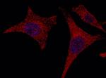 alanyl-tRNA Synthetase Antibody in Immunocytochemistry (ICC/IF)