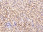 AKT2 Antibody in Immunohistochemistry (Paraffin) (IHC (P))