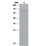 Arylsulfatase A Antibody in Immunoprecipitation (IP)