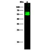 Arylsulfatase A Antibody in Western Blot (WB)