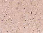 Butyrylcholinesterase Antibody in Immunohistochemistry (Paraffin) (IHC (P))