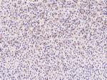 C1QB Antibody in Immunohistochemistry (Paraffin) (IHC (P))