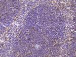 CD28 Antibody in Immunohistochemistry (Paraffin) (IHC (P))