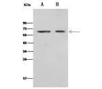 CD4 Antibody in Western Blot (WB)