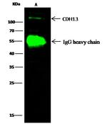 H-cadherin Antibody in Immunoprecipitation (IP)