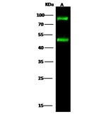 H-cadherin Antibody in Western Blot (WB)