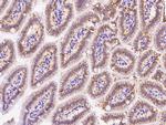 CDH17 Antibody in Immunohistochemistry (Paraffin) (IHC (P))