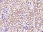 P-cadherin Antibody in Immunohistochemistry (Paraffin) (IHC (P))