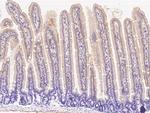 CD178 Antibody in Immunohistochemistry (Paraffin) (IHC (P))