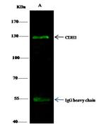 E-cadherin Antibody in Immunoprecipitation (IP)