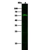 Growth Hormone Receptor Antibody in Western Blot (WB)