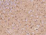 Glutamine Synthetase Antibody in Immunohistochemistry (Paraffin) (IHC (P))