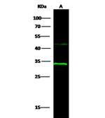 15-PGDH Antibody in Western Blot (WB)