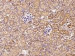 IL20RA Antibody in Immunohistochemistry (Paraffin) (IHC (P))