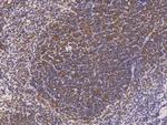 LILRB4 Antibody in Immunohistochemistry (Paraffin) (IHC (P))