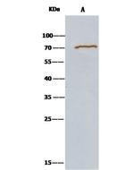 METAP2 Antibody in Immunoprecipitation (IP)