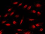 IkB beta Antibody in Immunocytochemistry (ICC/IF)