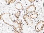 IkB beta Antibody in Immunohistochemistry (Paraffin) (IHC (P))