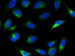 PCSK9 Antibody in Immunocytochemistry (ICC/IF)