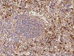 S100A9 Antibody in Immunohistochemistry (Paraffin) (IHC (P))