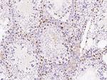 SALL4 Antibody in Immunohistochemistry (Paraffin) (IHC (P))