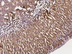 SLC27A3 Antibody in Immunohistochemistry (Paraffin) (IHC (P))