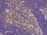 CD267 (TACI) Antibody in Immunohistochemistry (Paraffin) (IHC (P))