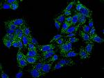 TREM1 Antibody in Immunocytochemistry (ICC/IF)