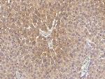 TREM1 Antibody in Immunohistochemistry (Paraffin) (IHC (P))