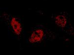 ARIH2 Antibody in Immunocytochemistry (ICC/IF)