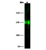 CD51 Antibody in Western Blot (WB)