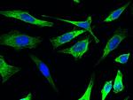 Cytokeratin 17 Antibody in Immunocytochemistry (ICC/IF)