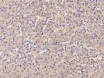 PIK3CG Antibody in Immunohistochemistry (Paraffin) (IHC (P))