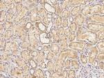 PIK3CG Antibody in Immunohistochemistry (Paraffin) (IHC (P))