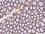 ECD Antibody in Immunohistochemistry (Paraffin) (IHC (P))