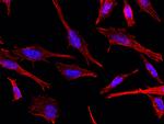 TAGLN Antibody in Immunocytochemistry (ICC/IF)