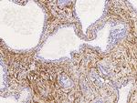 TAGLN Antibody in Immunohistochemistry (Paraffin) (IHC (P))