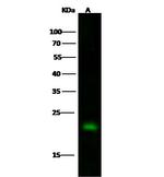 TAGLN Antibody in Western Blot (WB)