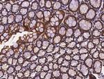 Profilin 1 Antibody in Immunohistochemistry (Paraffin) (IHC (P))