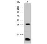 Profilin 1 Antibody in Western Blot (WB)