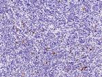 CD160 Antibody in Immunohistochemistry (Paraffin) (IHC (P))