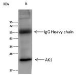 Adenylate Kinase 1 Antibody in Immunoprecipitation (IP)