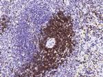 CD6 Antibody in Immunohistochemistry (Paraffin) (IHC (P))