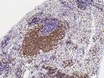 CD79b Antibody in Immunohistochemistry (Paraffin) (IHC (P))